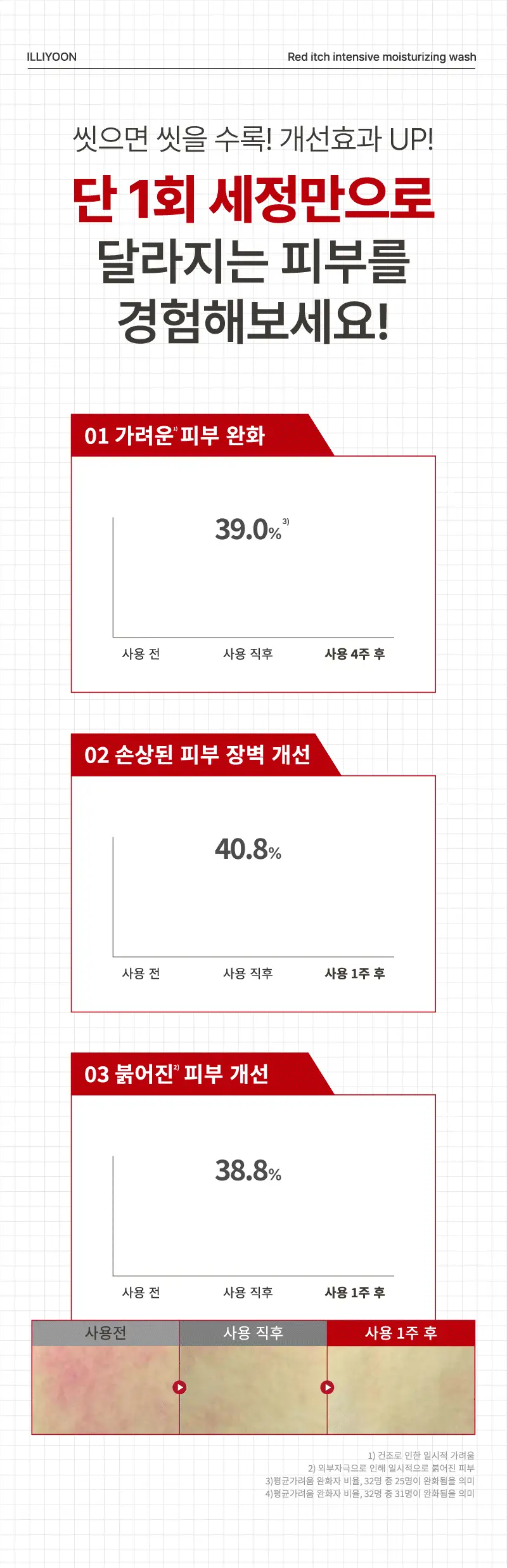 [가려움기능성] 일리윤 레드이치 케어크림 330ML 기획(오일 20ml 증정) 상세페이지 39